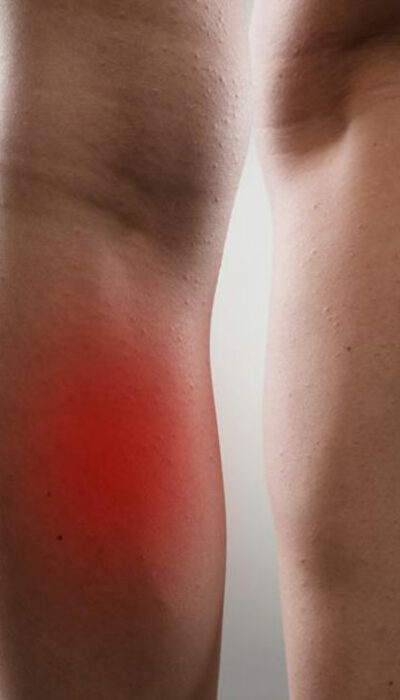 Common Causes and Treatments of Leg Muscle Pain