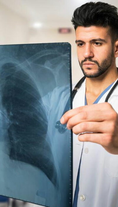 Common pulmonary embolism symptoms that you should be aware of