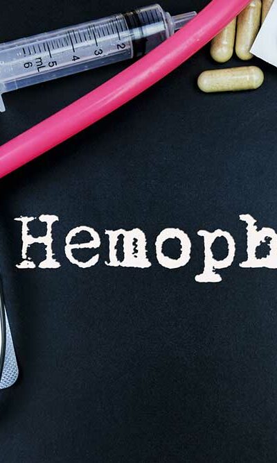 Causes, Symptoms, and Complications of Hemophilia