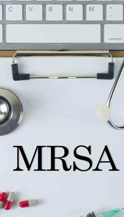 Causes, Symptoms and Treatment for MRSA