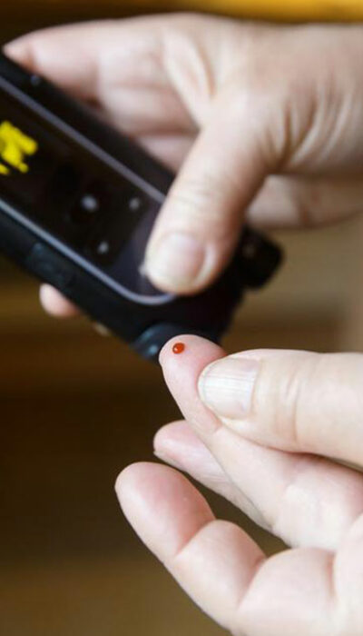 Causes, Symptoms and Treatment of Type 1 Diabetes