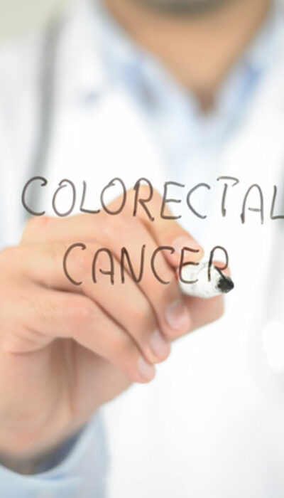 Causes and Diagnosis of Colorectal Cancer