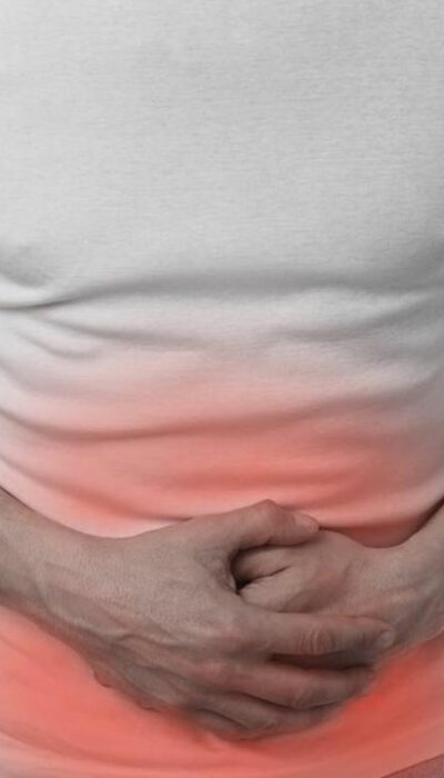 Causes and Treatment of Irritable Bowel Syndrome