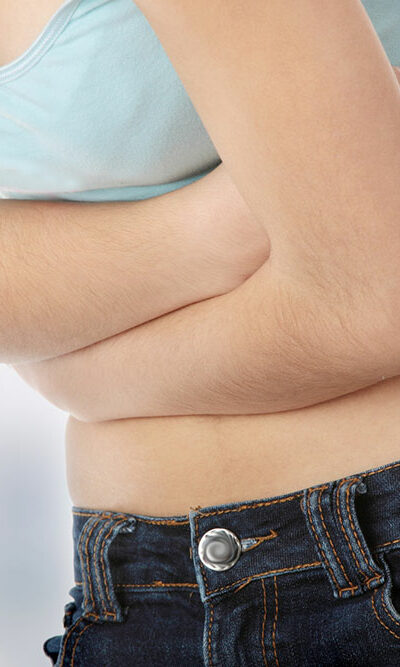 Causes and Treatments for a Bloated Stomach