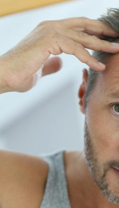 Causes and remedies of hair loss