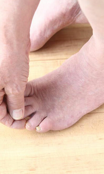 A Complete Guide to Diabetic Feet Care