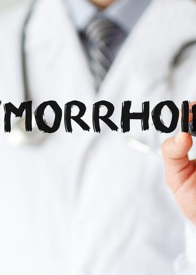 An Overview Of External Hemorrhoids- Causes, Symptoms, And Treatment