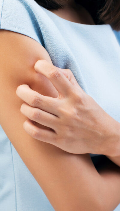 An Overview Of Skin Rashes And Its Treatment