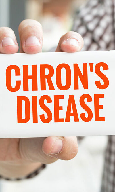 All You Need to Know about Chron&#8217;s disease