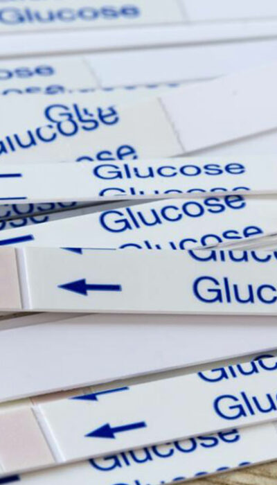 All You Need to Know about Blood Glucose Test