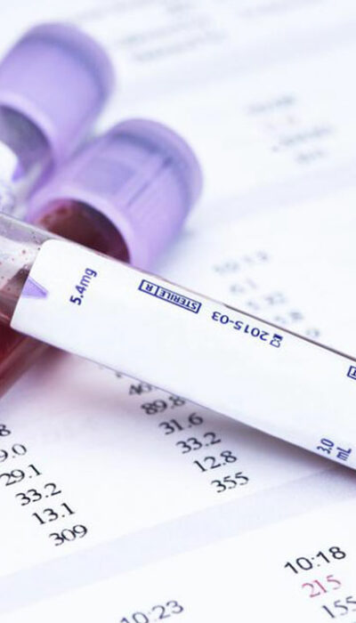 All You Need to Know about Glucose Levels Charts