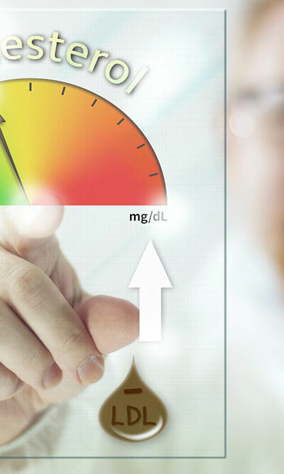 All You Need to Know about High Cholesterol Levels