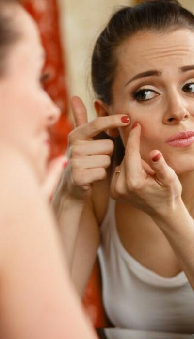 Basics of Adult Acne Treatment That You Need To Know