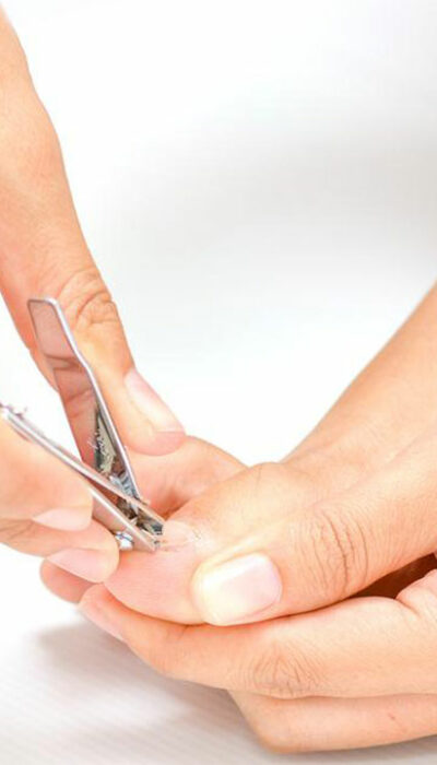 Best Toenail Fungus Remedies to Try at Home