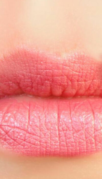 Get Quick Relief from Cold Sores