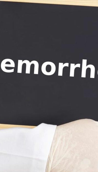 Get Relief with These Effective Hemorrhoids Treatment Options