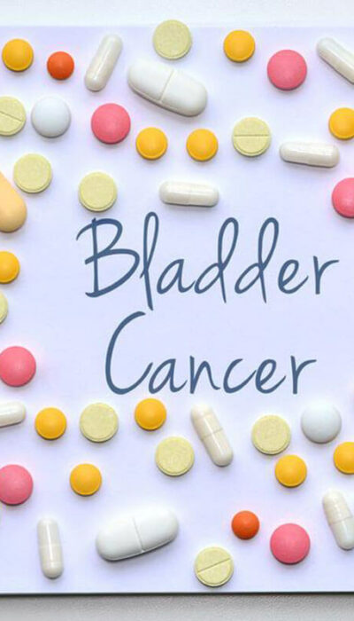 Do You Have Any of These Bladder Cancer Symptoms?