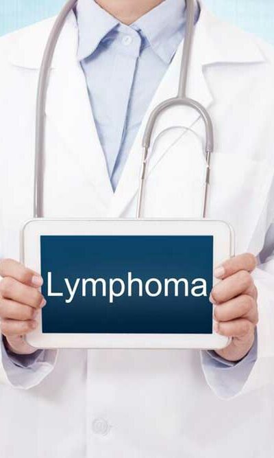 Different Types of Lymphoma You Should Know about