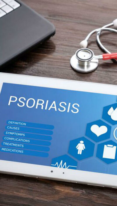 Easy DIY Remedies to Treat Psoriasis Symptoms