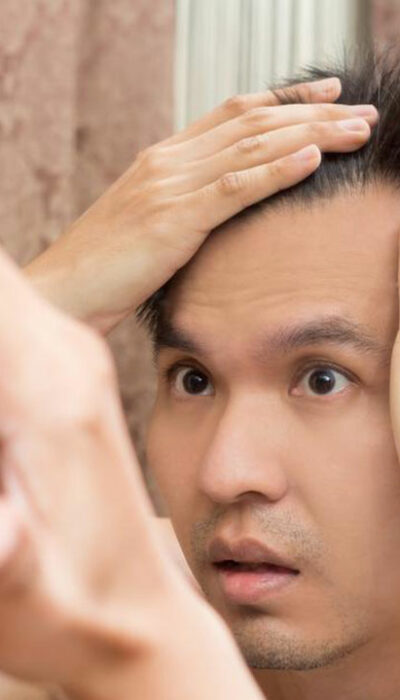 Effective Hair Loss Treatments for Thinning Hair