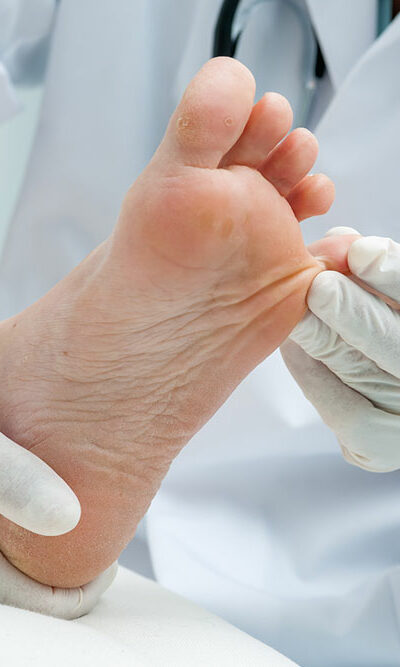 Effective Treatments for Toenail Fungus