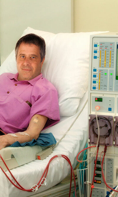 Essential Things to Know about Kidney Dialysis