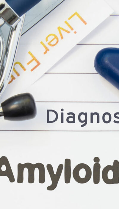 Everything About the Different Types of Amyloidosis