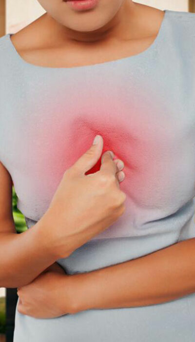 Everything You Need to Know About Heartburn