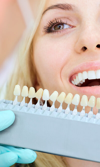 Everything You Need To Know About Dental Implants