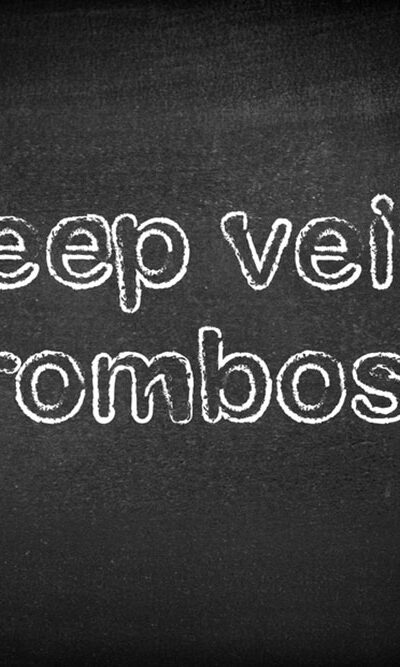 Everything to Know about Deep Vein Thrombosis