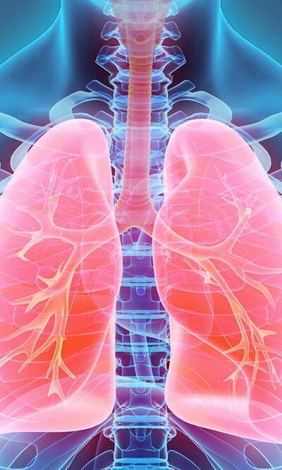 Everything you should know about lung cancer