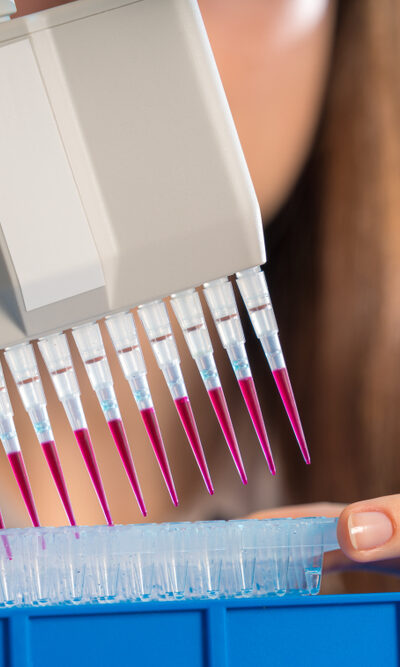 Factors To Consider While Choosing A Dna Testing Kit