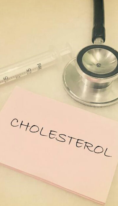 Few Important Measures and Treatments of High LDL Cholesterol