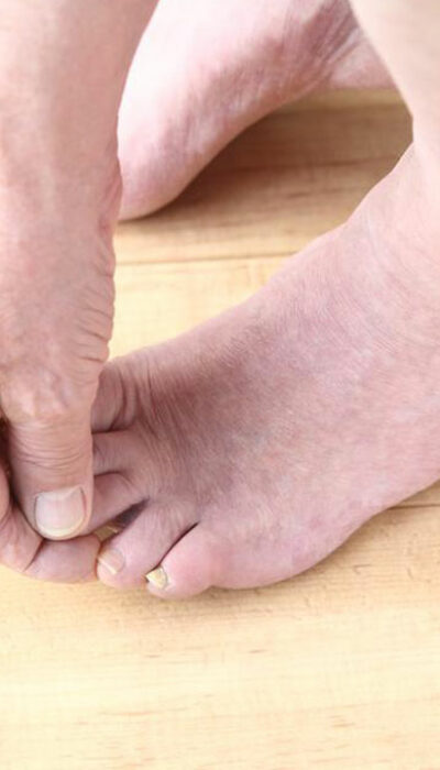 Fibromyalgia Foot Pain &#8211; Factors to Understand