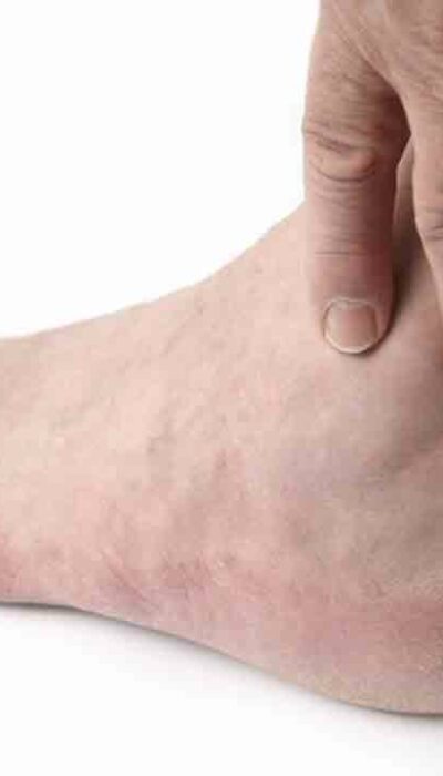 Find relief with these 5 home remedies for foot pain