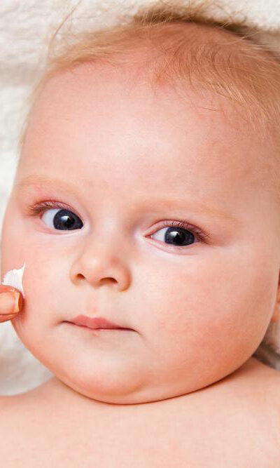 Know More About The Symptoms Causes And Treatment Options For Eczema In Infants