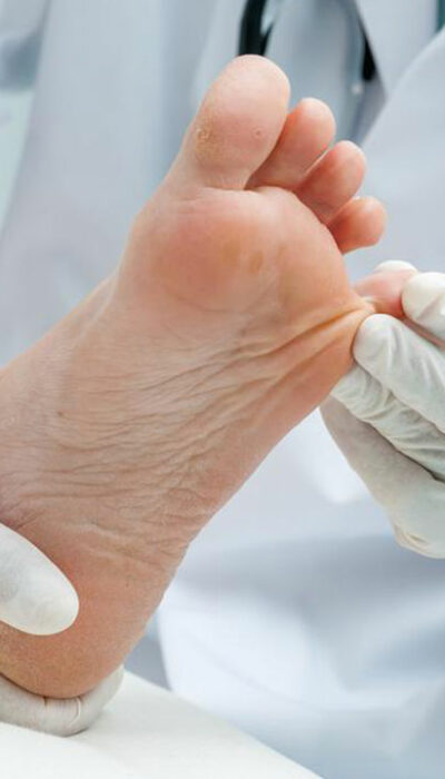 Know How Listerine Can Cure Your Toenail Fungus