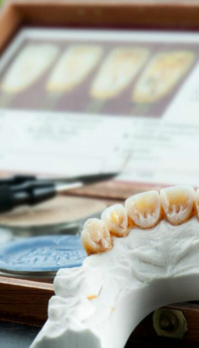 Know about the Average Cost of Dental Implants and Its Benefits