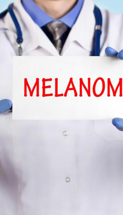 Know about the Diagnosis and Treatment Options for Metastatic Melanoma