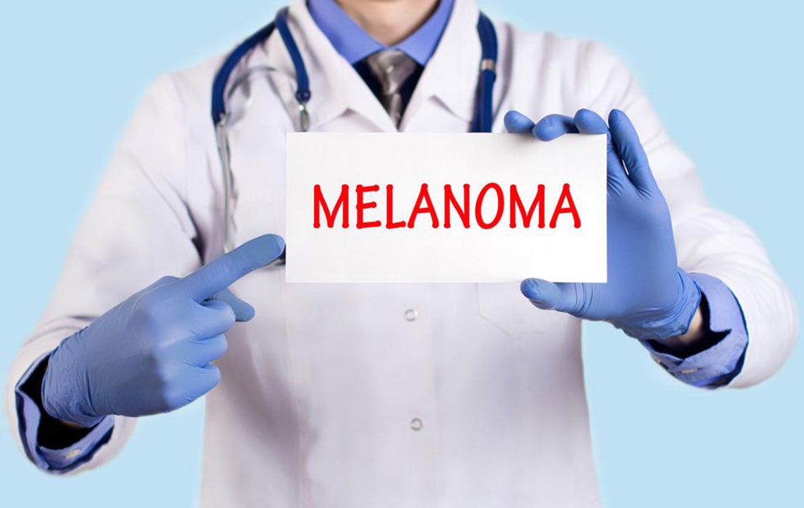 Know about the Diagnosis and Treatment Options for Metastatic Melanoma