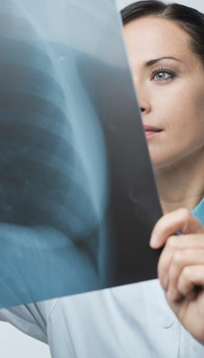 How to Choose the Right Chronic Bronchitis Treatment Center