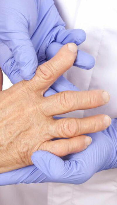 How to Detect the Early Signs of Rheumatoid Arthritis