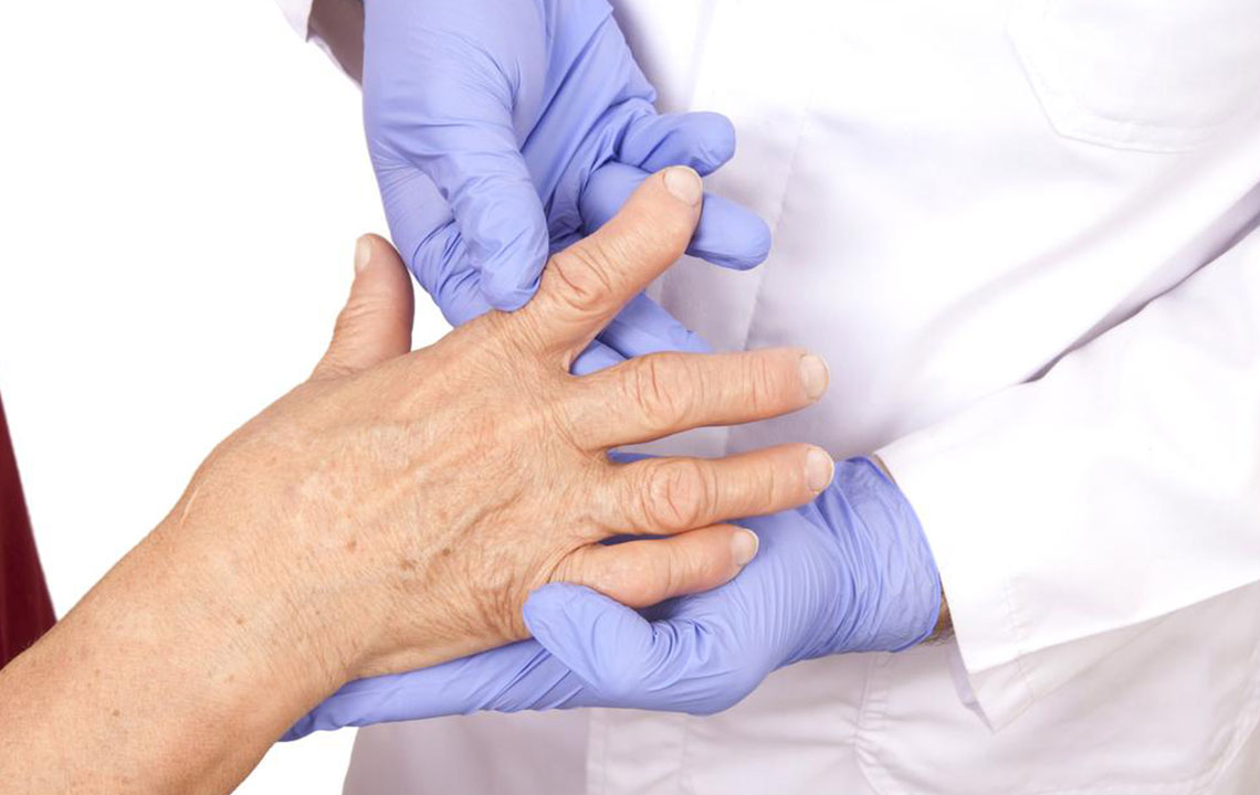 How to Detect the Early Signs of Rheumatoid Arthritis