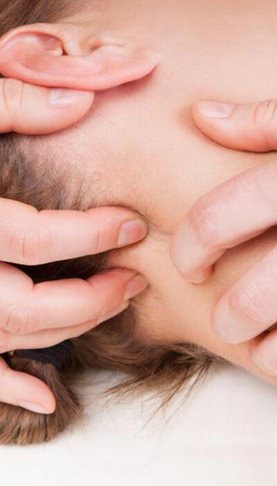 How to Rectify the Loose Skin on Your Neck