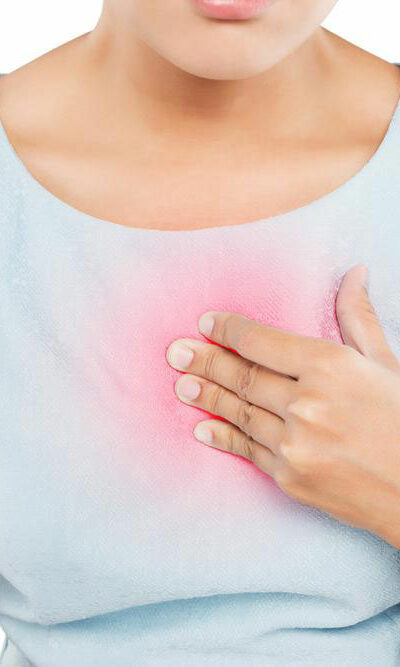 How to Treat and Prevent Heartburn and Indigestion