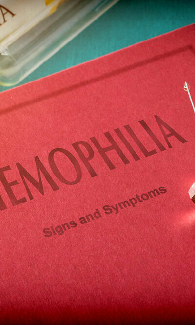 Hemophilia &#8211; 4 main symptoms and their severity