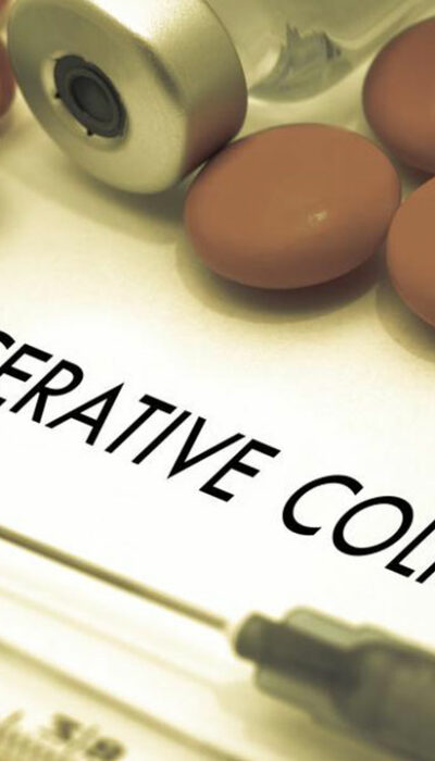 Here Are Some of the Popular Ulcerative Colitis Treatments