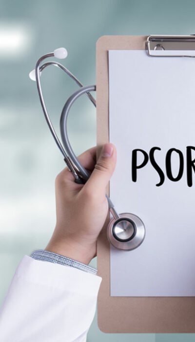 Here are Some Treatment Options for Psoriasis