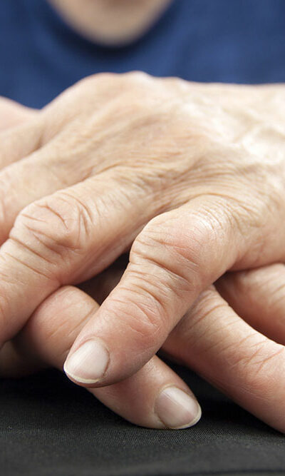 Here is what you must know about rheumatoid arthritis