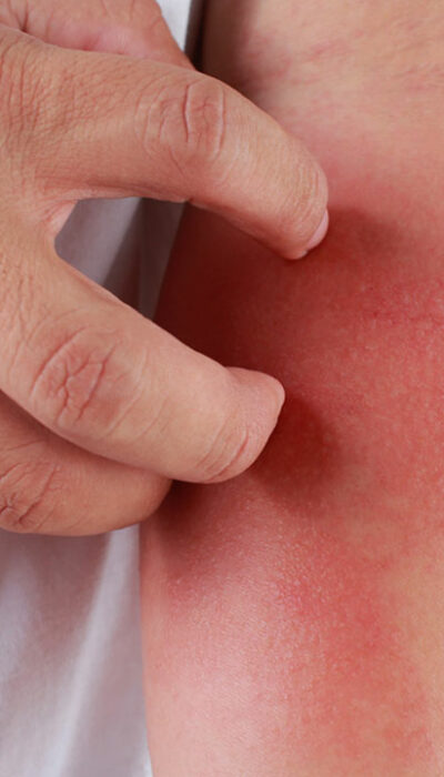 Here&#8217;s How to Identify a Skin Rash